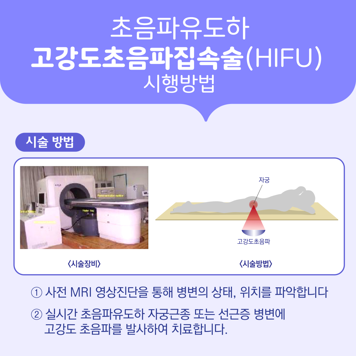초음파 유도하 고강도초음파 집속술 (자궁근종, 자궁선근증) 이미지7