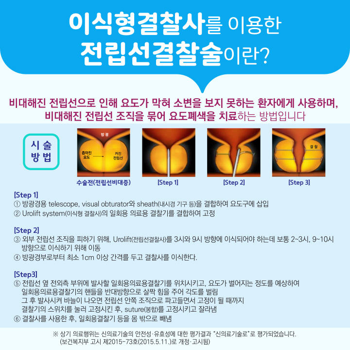 이식형결찰사를 이용한 전립선결찰술 이미지6