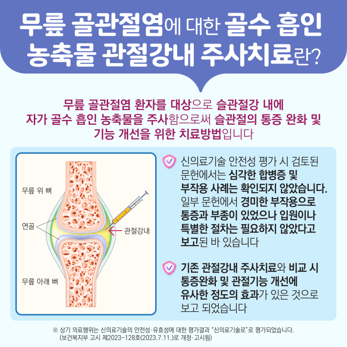 무릎 골관절염에 대한 골수 흡인 농축물 관절강내 주사(BMAC) 이미지6