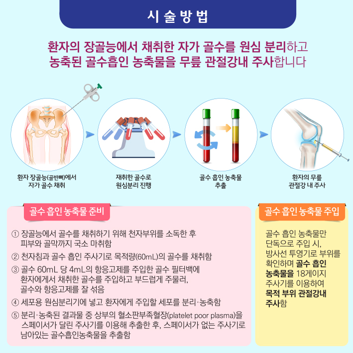 무릎 골관절염에 대한 골수 흡인 농축물 관절강내 주사(BMAC) 이미지7